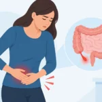 Cómo detectar apendicitis temprana y actuar a tiempo