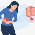 Cómo reconocer una apendicitis a tiempo