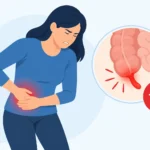 Signos de apendicitis complicada que exigen urgencias